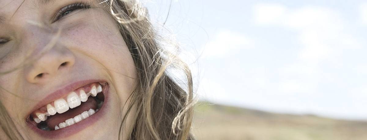 Girl wearing ceramic braces