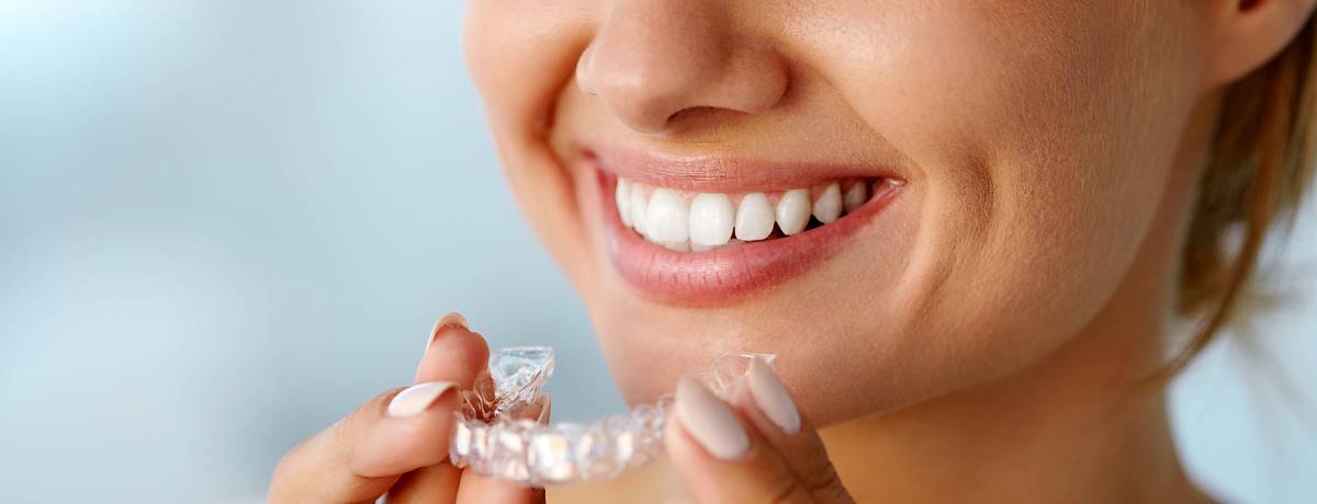 Young woman fitting clear aligner